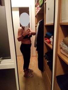 1 mėnuo po operacijos