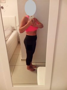 2 mėnesiai po operacijos